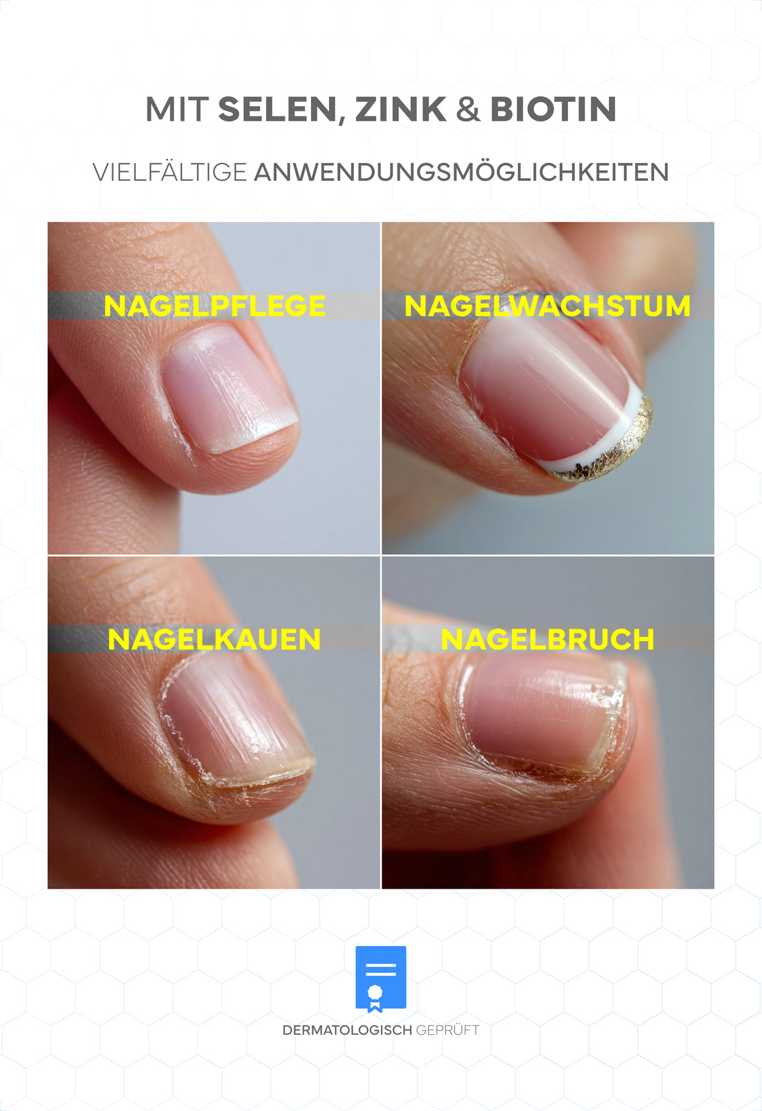 Propolis Nagelserum, 10ml - Akutpflege bei Nagelpilz, mit hochdosiertem Bio-Propolisextrakt sowie Teebaumöl, Zink, Selen & Biotin, für gesunde & starke Nägel