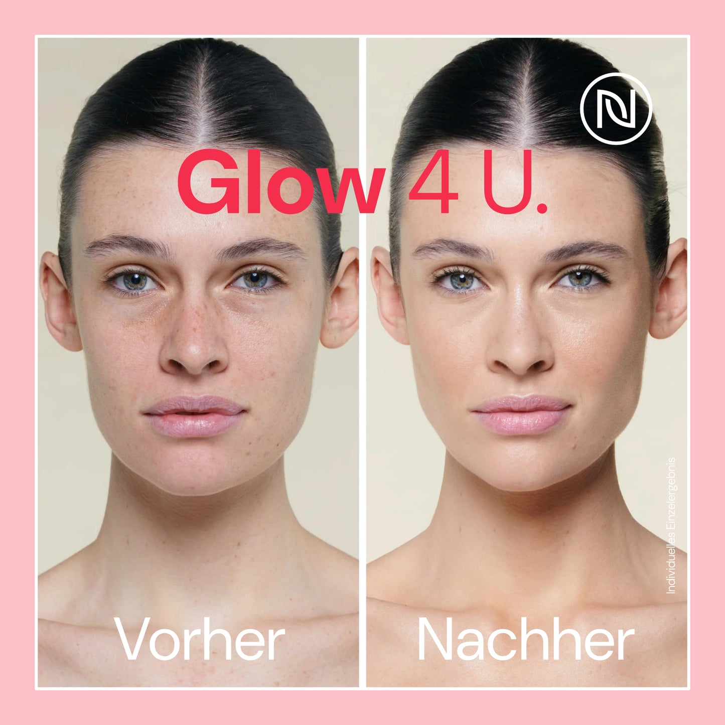BIO Vitamin C Pro Serum 10% hochdosiert - 6-Fach Anti Aging & Anti Falten Komplex; Gegen dunkle Flecken; Mit Hyaluronsäure & Aloe Vera; Naturkosmetik 100% vegan; Made in Germany (100ml, Vitamin C)